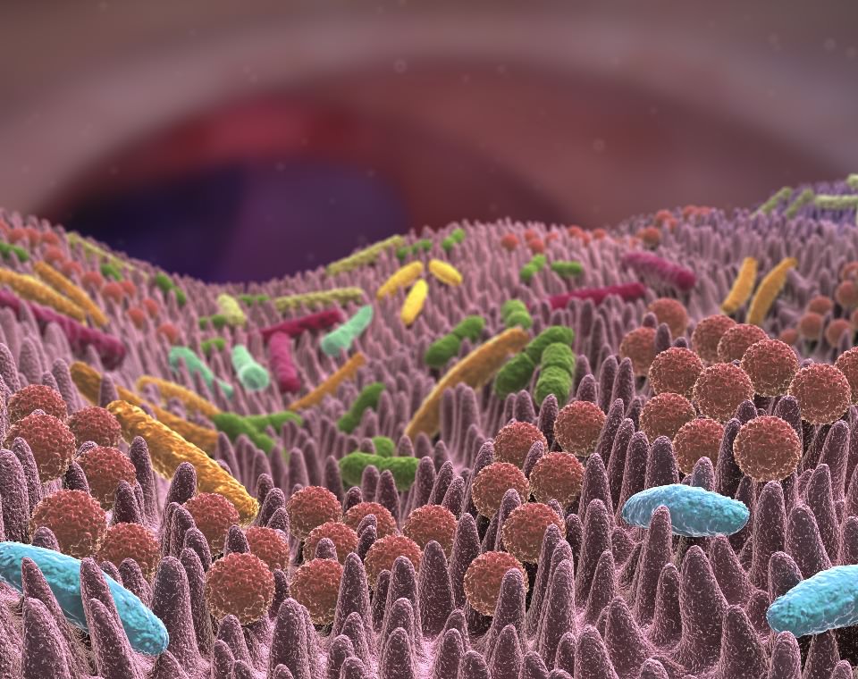 Dysbiosis